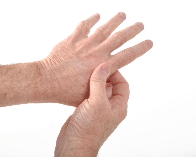 Signs of Rheumatoid Arthritis Can Show Up Long Before Diagnosis