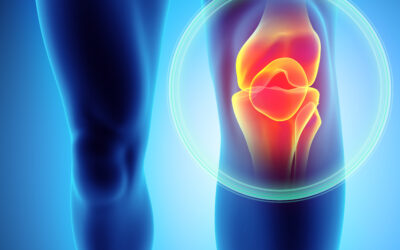 Obesity to Blame for Epidemic of Knee Dislocations, Complications ...