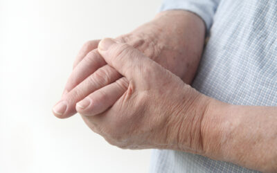 Injected Drug May Be New Weapon Against Gout