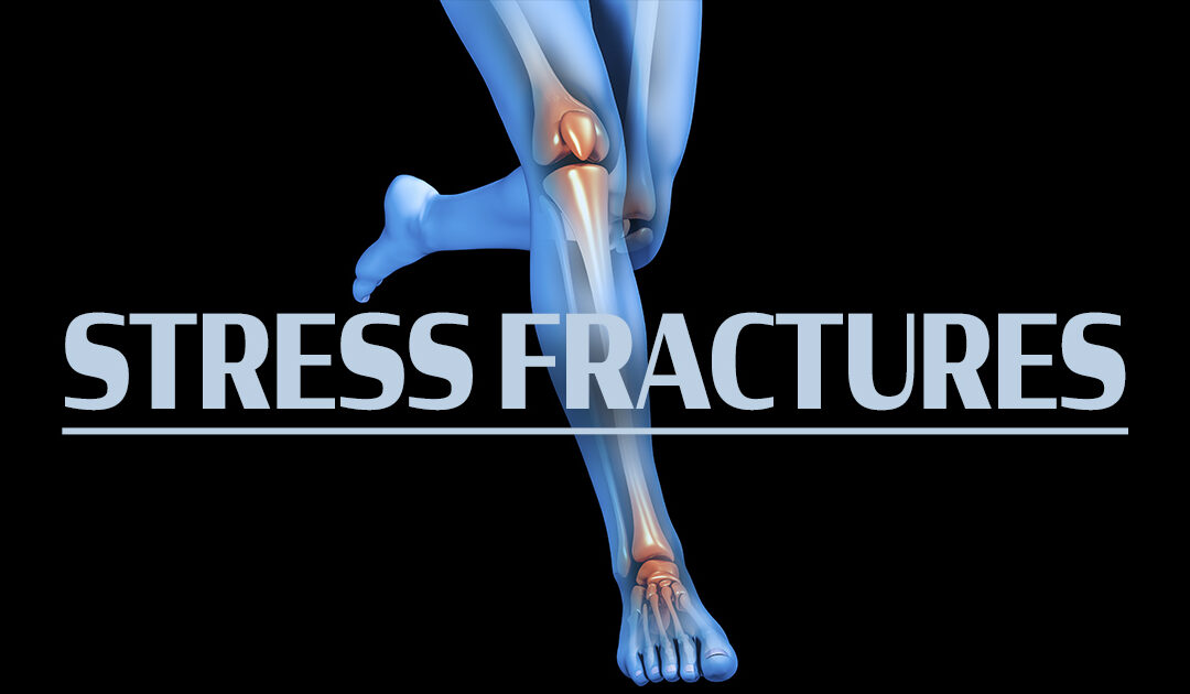 Spring Activity Can Sometimes Bring Stress Fractures